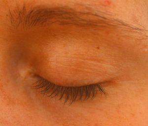 Eyelash